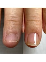 ラミーネイル(Ramie nail)/自爪育成ケアコース