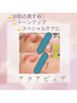 ユララ(YURARA)/毛穴にはアクアピュア♪