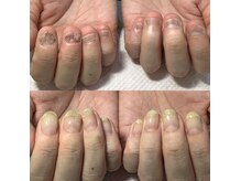 ネイルアトリエ スミレ(nail atelier Sumire)の雰囲気（自爪育成メニュー有！お悩みご相談ください^^）