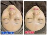 【A&C】お顔のトータルケアが叶う♪黒ずみも気になる乾燥も気になる方必見◎