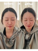 ティアラ(tiara)/小顔ハーブ蒸し