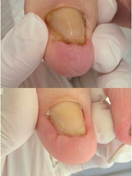 ハビッツ(habits)/指先クリーニングで清潔に