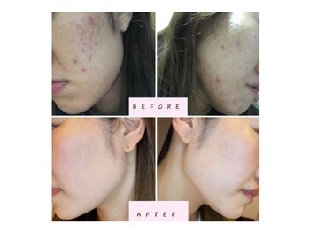 パルティール 銀座店 partir/パスリルリュクスの効果【銀座】