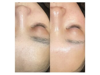 モカラ(MOKARA)/フェイシャルワックス