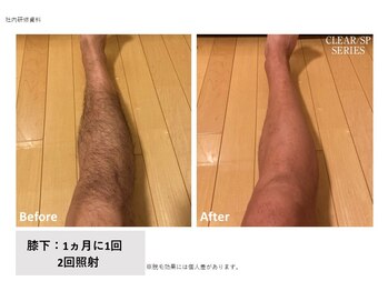 アマナ(AMANA)/短パンも気軽に履ける♪