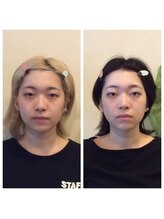 健幸堂 本店/小顔矯正1回→6回