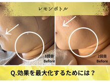 オートクチュール エステティックサロン シーズ/効果を最大化するために