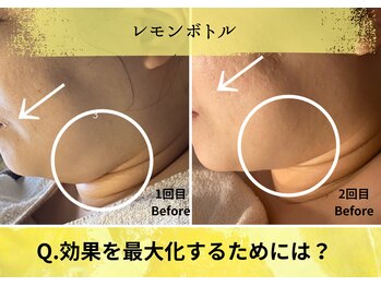 オートクチュール エステティックサロン シーズ/効果を最大化するために