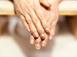 冬のブラウンマグネット