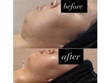 マヤヒメ(mayahime)/オンダリフト