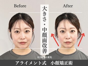 アライメントトウキョウ 表参道(Alignment TOKYO)/大きさ・中顔面