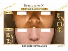 ナンバー(N°)の雰囲気（シミ・毛穴ケア￥15000→11900）