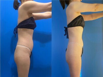 ソイズ 上中居店(SOIS)/インド痩身