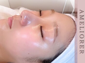 アメリオレ 三鷹店(AMELIORER)の写真/韓国肌管理ララピールの進化版《セラピール》でツヤ肌爆誕！ダウンタイム無しで水光肌へ♪敏感肌の方も◎