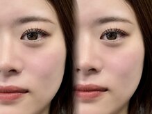 ミライ トータルビューティーサロン(mirai)/カールパーマで可愛い印象に☆