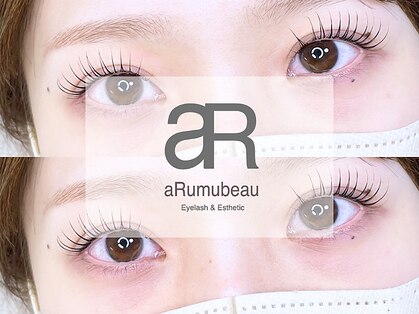 アルムビュー(aRumubeau)の写真