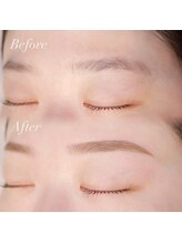 イデアル(ideal)/<美眉>ハリウッドブロウリフト