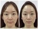 センガン(SENGAN)の写真