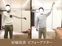 オリエンタル整体院 新潟院/50代 製造業 肩こり改善成果