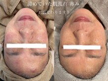 シェア(share.)/諦めていた赤みにも◎