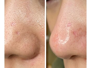 サイ(Sai)/before⇒after