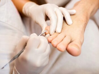 すみか(sumi家)の写真/何度も繰り返す足トラブルに終止符を!痛みが出るほどの巻き爪、タコ・魚の目、かかとや足裏のカサカサに◎