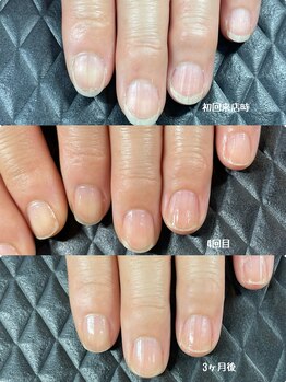 クーラ アンド ベリッシモ(Cura&Bellissimo)/