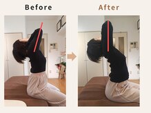 ハリデイズ/40代-肩こり、首こり、頭痛