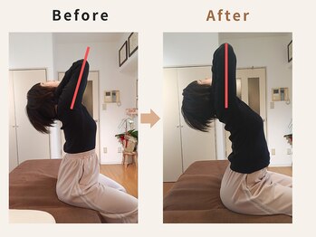 ハリデイズ/40代-肩こり、首こり、頭痛