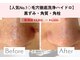 リアン(Lien)の写真