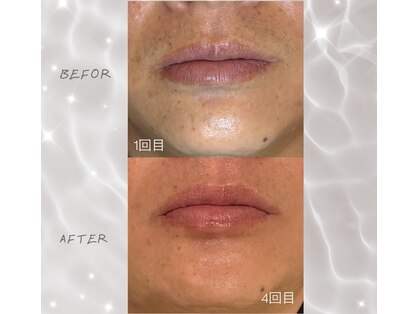 ソワンドボーテ クー(Soin de Beaut'e Quu)の写真