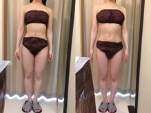 ハッテンビューティーパーク 神戸店(Hatten Beauty Park 810)/モニター様ビフォーアフター