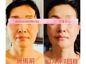 ウルワシ(Uruwashi)/★ビフォーアフター★