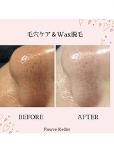 フルーヴ ルフレ(Fleuve Reflet)/毛穴ケア＆ワックス脱毛！