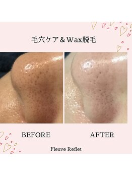 フルーヴ ルフレ(Fleuve Reflet)/毛穴ケア＆ワックス脱毛！