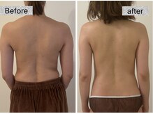 ナチューラ(Natura)/一度の施術で痩身効果バッチリ！