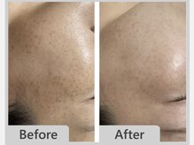 エマクラン(emmaclan)/