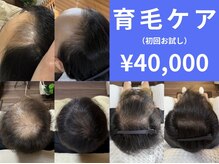 フェリス(FELIZ)の雰囲気（【ブログにて症例多数】老若男女頭皮問題幅広くあらゆる世代に◎）