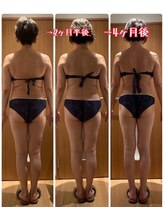 パルティール 銀座店 partir/後ろ姿！効果絶大！！【銀座】