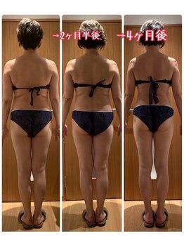 パルティール 銀座店 partir/後ろ姿！効果絶大！！【銀座】