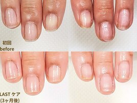 地爪育成｜3ヶ月後変化