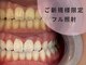 ナルムホワイトニング 代々木(NARUM whitening)の写真/【北参道,ホワイトニング】通いやすい適正価格◎清潔感UPで第一印象を格上げ！最新機器で自然な白い歯へ