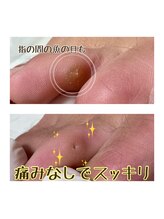 エアリー 昭島(Airily)/つらい悩みも解決！