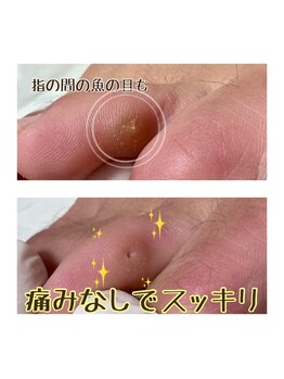 エアリー 昭島(Airily)/つらい悩みも解決!