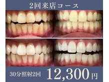グリッター ショウナン(glitter.SHONAN)の雰囲気（短時間で早く白くしたい方にオススメ♪）