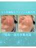 幹細胞エクソソーム肌管理◎花粉などのゆらぎ肌にもオススメ◎ ¥15,000