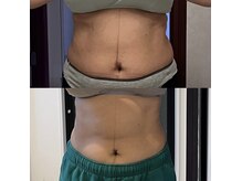 ベリッシマ(Bellissima)の雰囲気（予算＆肌悩みにあったスキンケア&インナーケアをお伝えします☆）