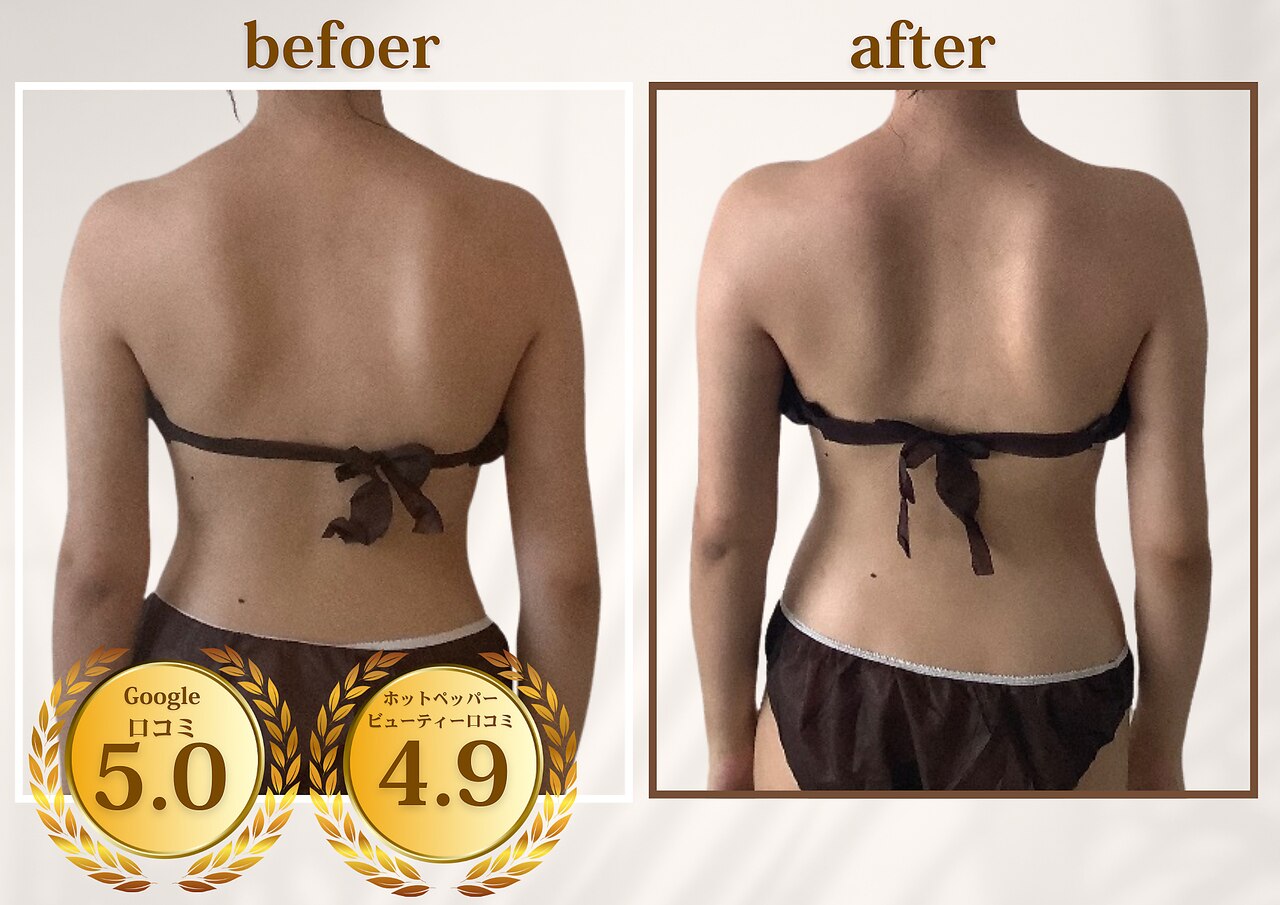 乃木坂駅でダイエットが人気のエステサロン｜ホットペッパービューティー