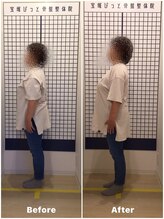 宝塚ぴっと骨盤整体院/腰痛が強くて仕事に支障がくる