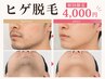 【ご新規様　ヒゲ脱毛】　￥4,000/40分　ヒゲ剃りから解放される　メンズ脱毛